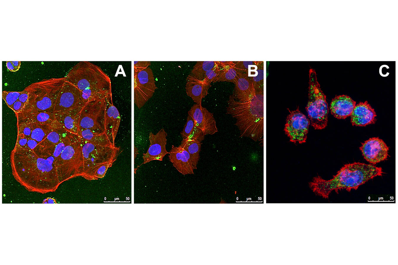 Abbildung 3: Die Aufnahme der Mikropartikel in (A) Caco2-, (B) HepG2- und (C) J774A.1-Makrophagen-Zellen, beobachtet mit konfokaler Mikroskopie; grün = Partikel, blau = Zellkerne, rot = Aktinfilamente (Copyright: Sphera)